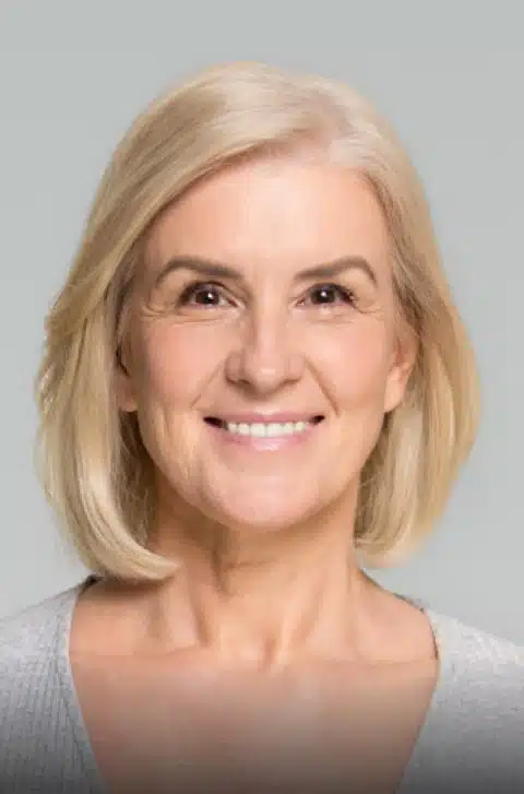 Facelift