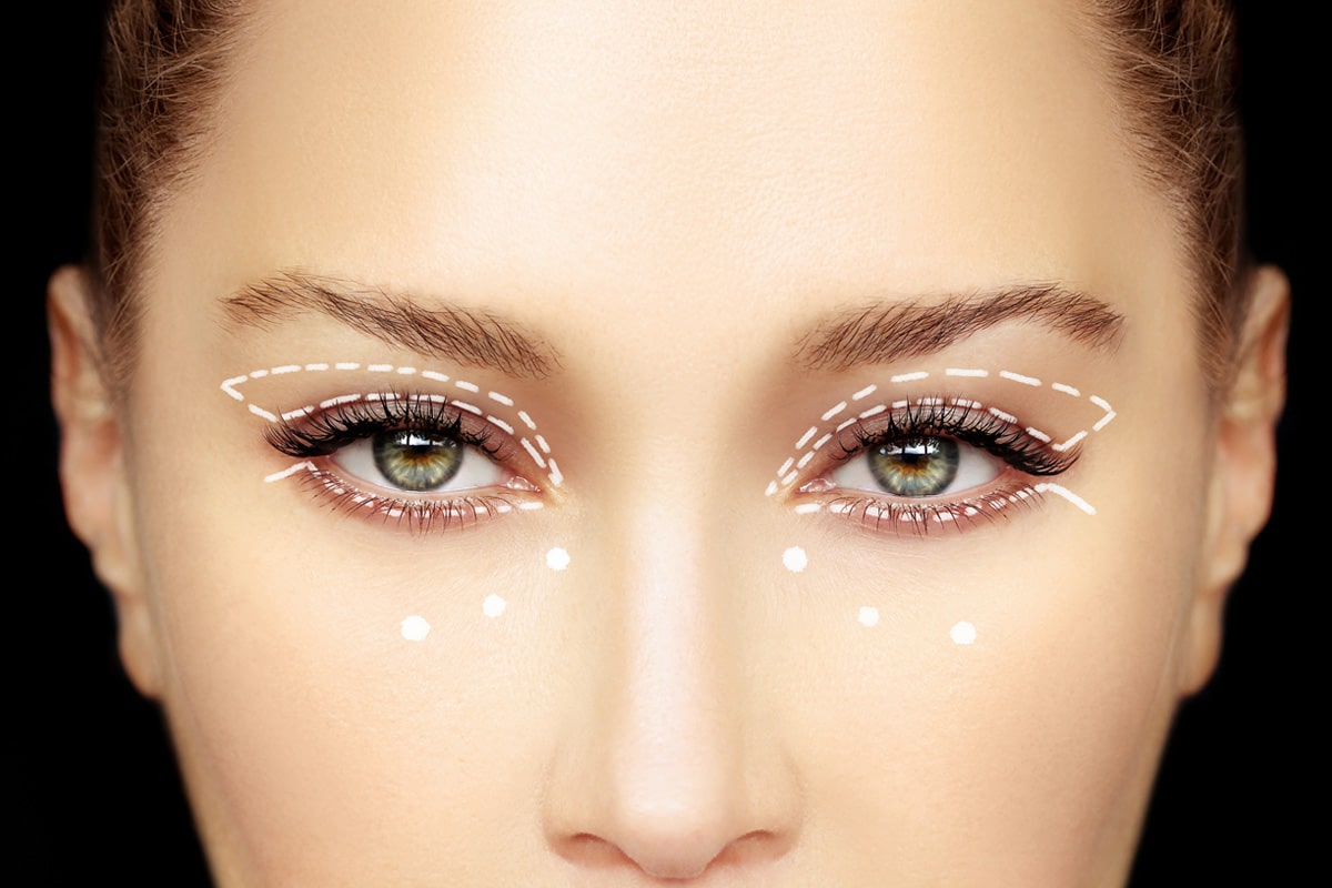 Upper vs Lower Blepharoplasty: Understanding the Differences