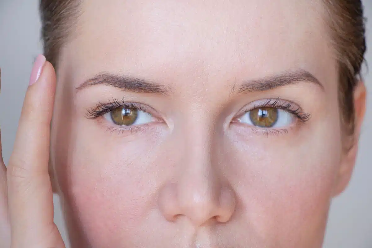 Laser or Traditional Blepharoplasty – Which Technique Suits You Best?