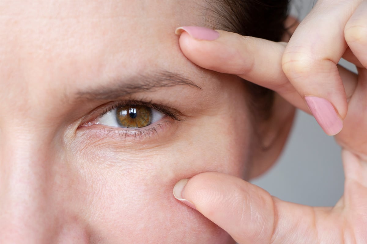 How to Reverse a Previous Eyelid Surgery?