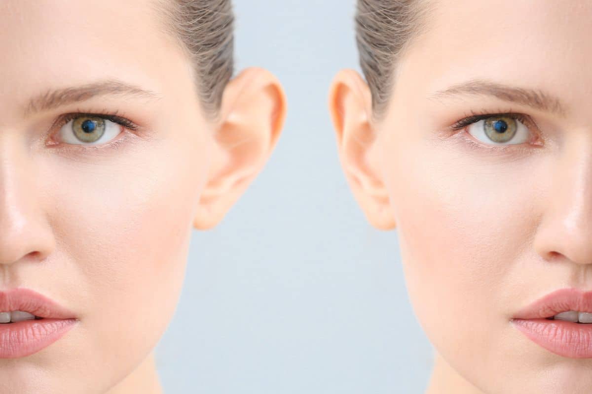 Immediate Benefits of Otoplasty for Better Ear Appearance