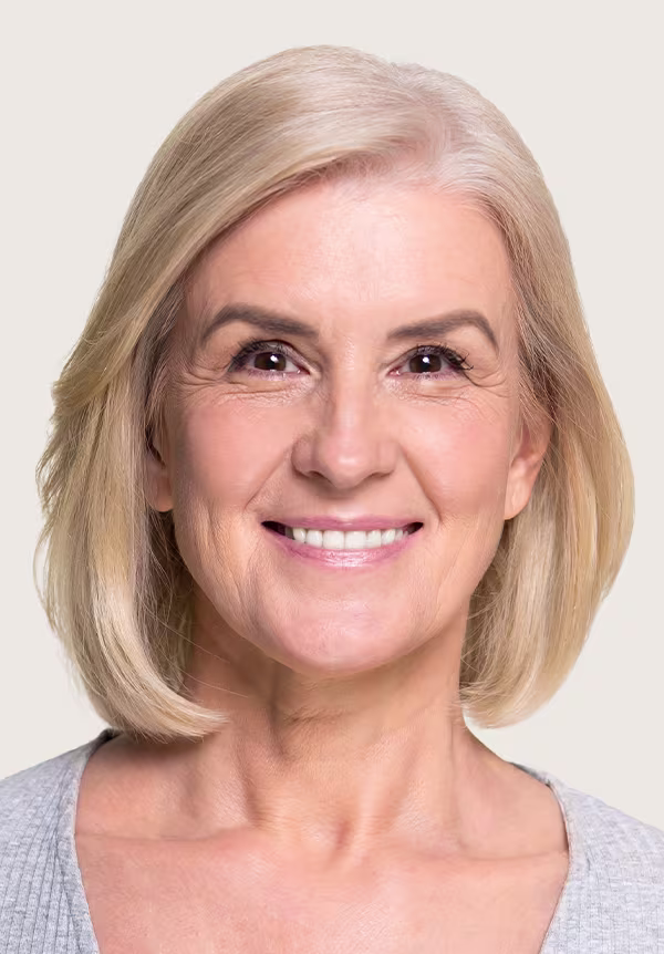 Facelift
